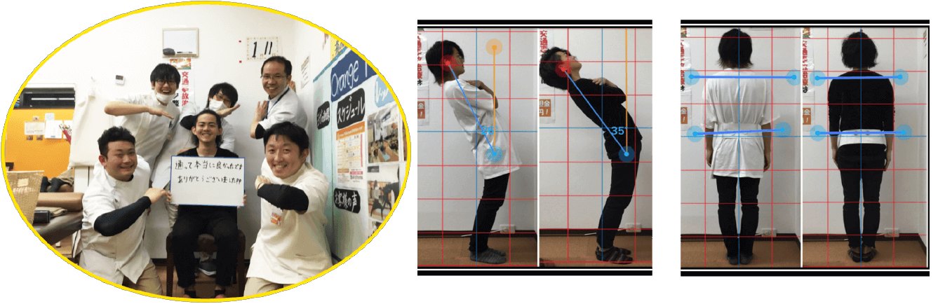 腰痛が改善した患者様の写真と姿勢ビフォーアフター