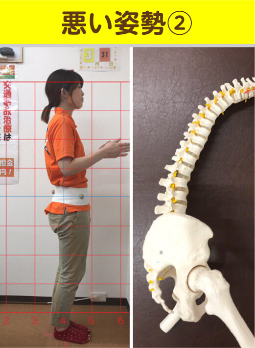 悪い姿勢2 姿勢と骨格模型の比較
