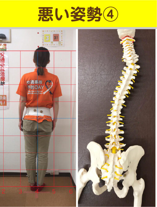 悪い姿勢4 姿勢と骨格模型の比較