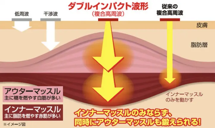 複合高周波のイメージ