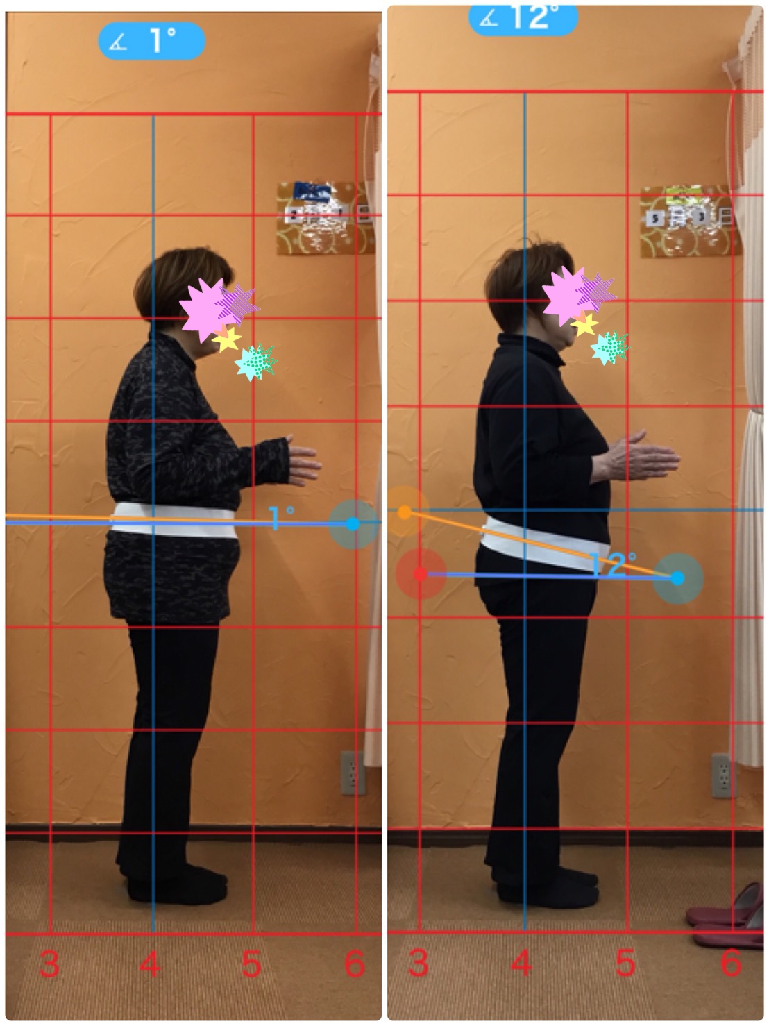 姿勢のビフォーアフター写真(横向き)